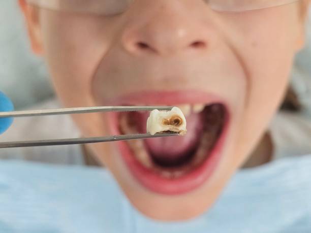 Best Emergency Dental Care for Abscessed Tooth in Raymondville, TX